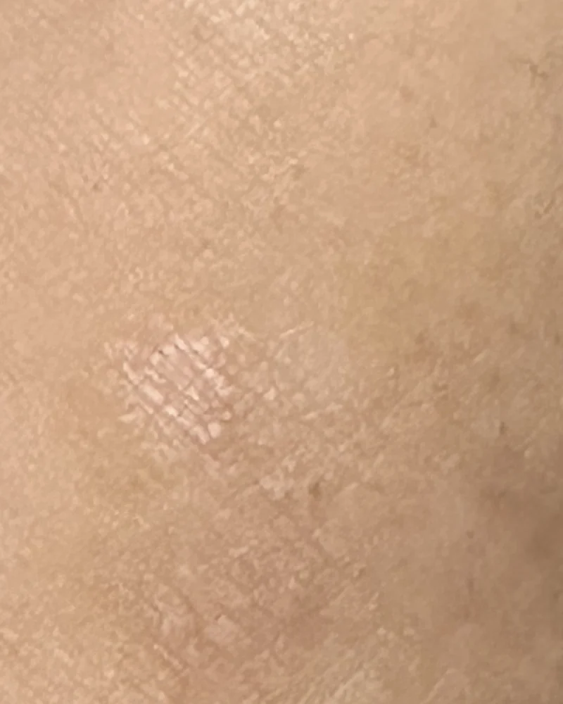 The same inner-elbow area photographed on 29 August 2026 under different light