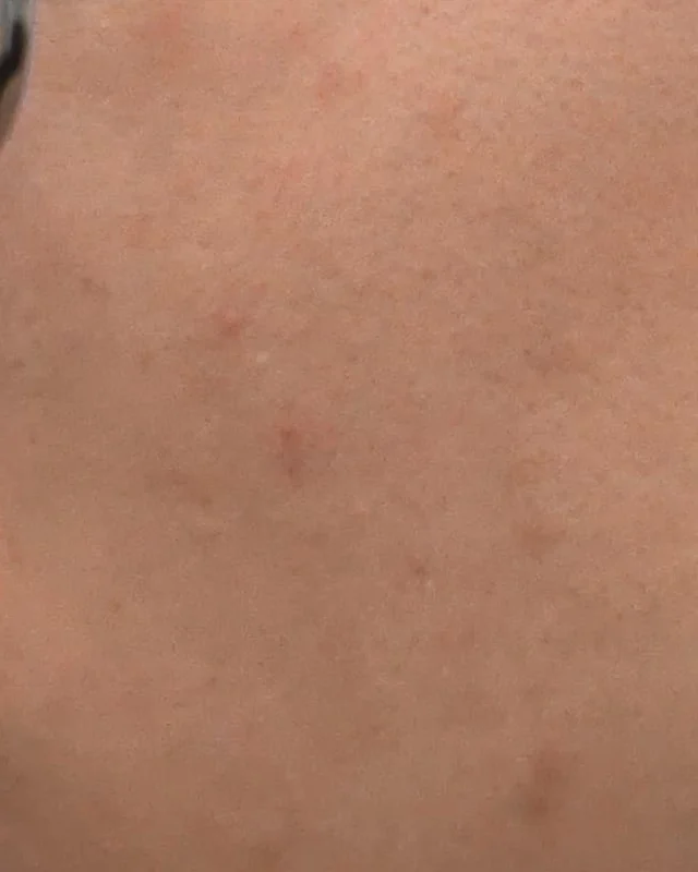 Skin-only crop of the left cheek at the first weekly check-in under different lighting