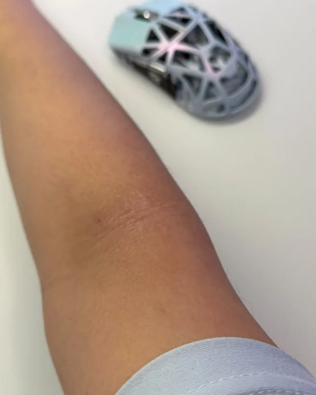 The right arm in the photograph taken on 27 September 2026