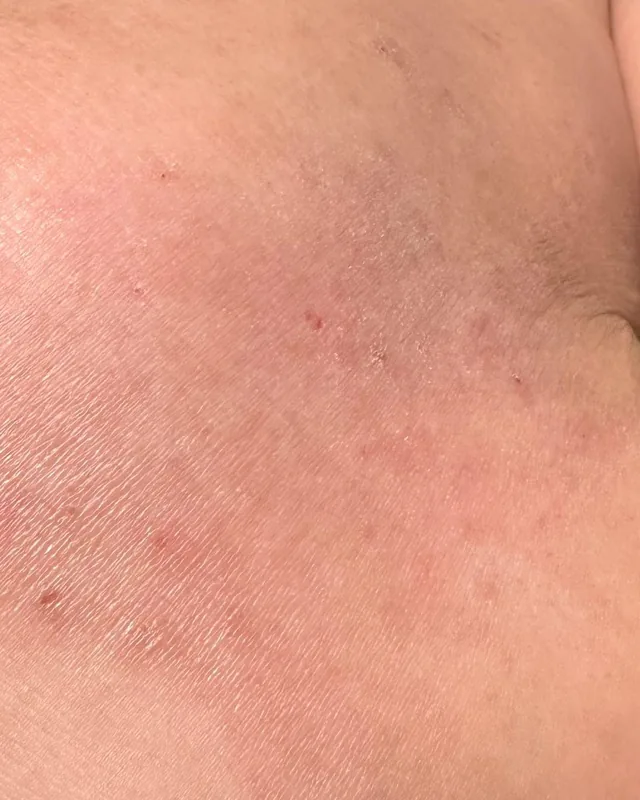 Close crop of upper-arm skin photographed on 18 July 2026